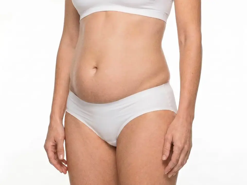 Abdominoplastia