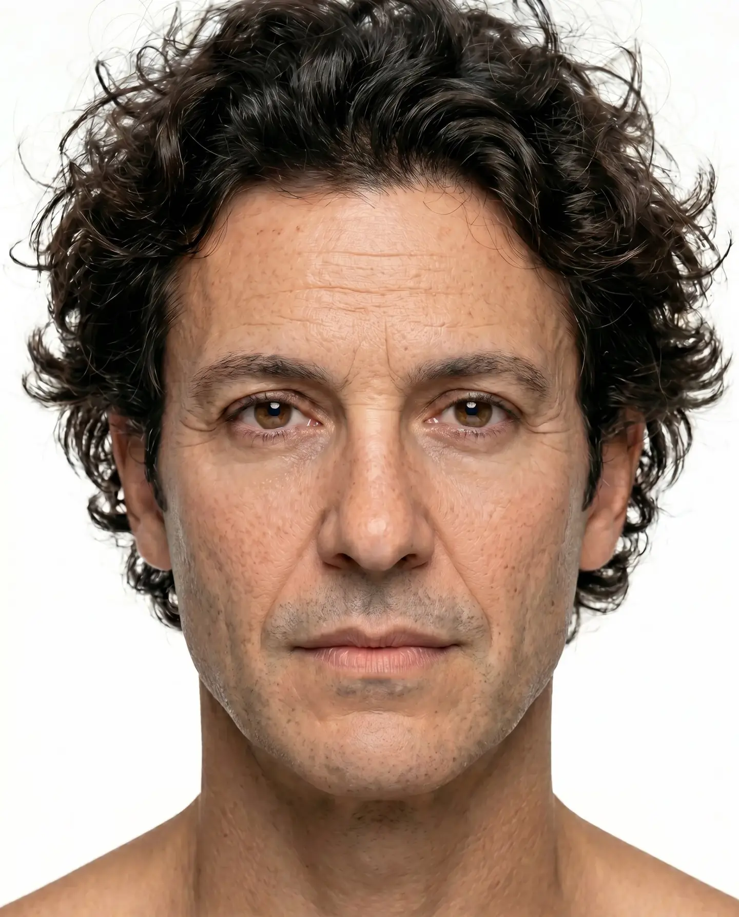 Lifting Facial · Clínica Barragán