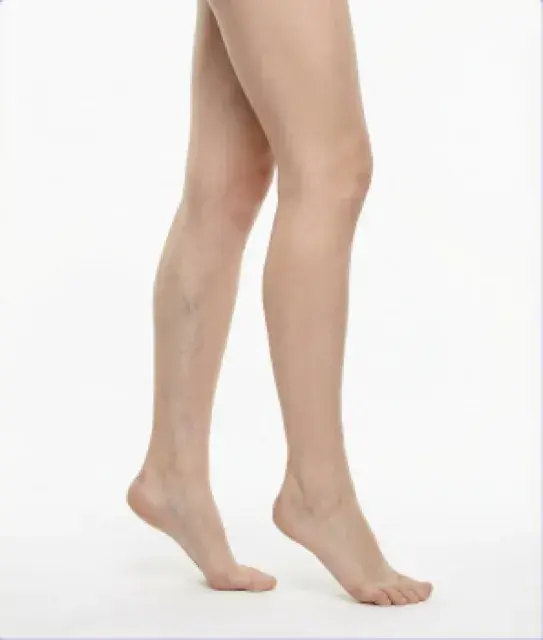 Tratamientos para Varices · Corporal