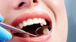 endodoncia clinica madrid