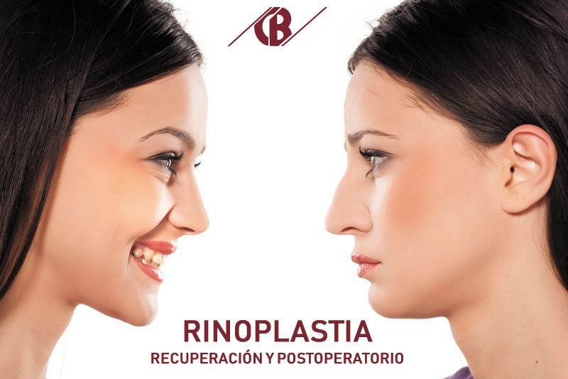 Recuperación y Postoperatorio de una Rinoplastia