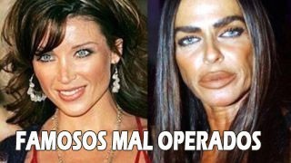 Los famosos peor operados
