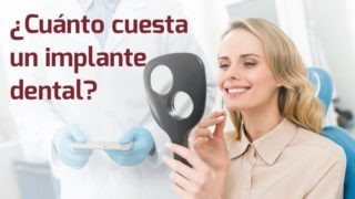 Precio de ponerse implantes dentales