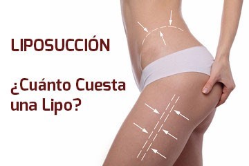 PRECIO LIPOSUCCIÓN – ¿Cuánto cuesta hacerse una lipoescultura?