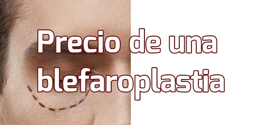 Precio Blefaroplastia – ¿Cuánto cuesta hacerse una Cirugía de Párpados?